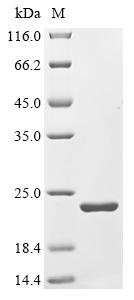 Greater than 90% as determined by SDS-PAGE.Recombinant Mouse Putative Hydrolase Rbbp9 (RBBP9) Protein (His)