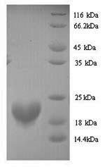 Greater than 90% as determined by SDS-PAGE.Recombinant Human Putative Rna-Binding Protein 3 (RBM3) Protein (His)