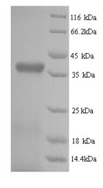 Greater than 90% as determined by SDS-PAGE.