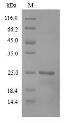 Greater than 90% as determined by SDS-PAGE.Recombinant Human Recoverin (RCVRN) Protein (His)