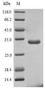 Greater than 90% as determined by SDS-PAGE.Recombinant Human Ribonuclease 4 (RNASE4) Protein (His-sumostar)