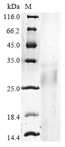 Greater than 90% as determined by SDS-PAGE.Recombinant Human Ribonuclease T2 (RNASET2) Protein (His-Myc)
