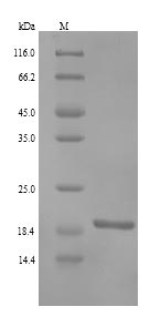 Greater than 90% as determined by SDS-PAGE.Recombinant Human Ring Finger Protein 11 (RNF11) Protein (His)