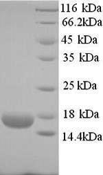 Greater than 90% as determined by SDS-PAGE.Recombinant Human Ropporin-1B (ROPN1B) Protein (His)