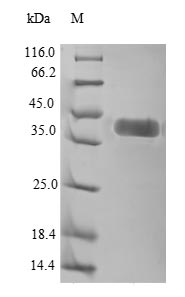 Greater than 90% as determined by SDS-PAGE.Recombinant Human Tyrosine-Protein Kinase Transmembrane Receptor Ror1 (ROR1) Protein (His)
