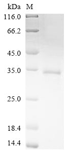Greater than 85% as determined by SDS-PAGE.Recombinant Human Nuclear Receptor Ror-Alpha (RORA) Protein (His)