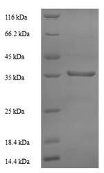 Greater than 90% as determined by SDS-PAGE.Recombinant Human 60S Acidic Ribosomal Protein P0 (RPLP0) Protein (His)