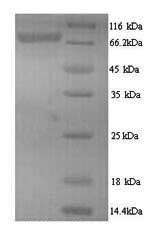 Greater than 90% as determined by SDS-PAGE.Recombinant Human Ribonucleoside-Diphosphate Reductase Large Subunit (RRM1) Protein (His)