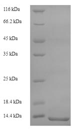 Greater than 90% as determined by SDS-PAGE.Recombinant Rat Protein S100-A8 (S100A8) Protein (His)