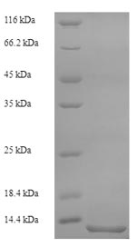 Greater than 90% as determined by SDS-PAGE.Recombinant Cat Serum Amyloid A Protein (SAA1) Protein (His)