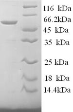 Greater than 90% as determined by SDS-PAGE.Recombinant Human S-Arrestin (SAG) Protein (His)
