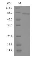 Greater than 90% as determined by SDS-PAGE.Recombinant Human Semenogelin-2 (SEMG2) Protein (His)
