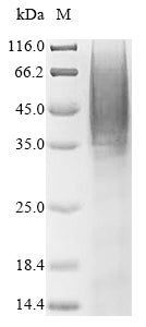 Greater than 90% as determined by SDS-PAGE.Recombinant Human Selenoprotein P (SELENOP) Protein (His)