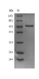 Greater than 90% as determined by SDS-PAGE.Recombinant Rat Alpha-1-Antiproteinase (SERPINA1) Protein (His)