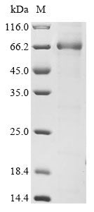 Greater than 85% as determined by SDS-PAGE.Recombinant Human Serpin B7 (SERPINB7) Protein (GST)