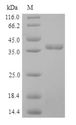 Greater than 90% as determined by SDS-PAGE.Recombinant Human Pulmonary Surfactant-Associated Protein D (SFTPD) Protein (His)