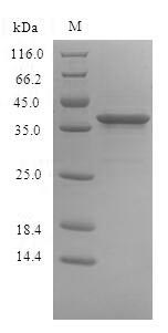 Greater than 90% as determined by SDS-PAGE.Recombinant Human Signal-Regulatory Protein Beta-1 (SIRPB1) Protein (His)