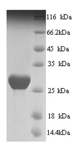Greater than 90% as determined by SDS-PAGE.Recombinant Human Prestin (SLC26A5) Protein (His/Tag-Free)