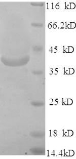 Greater than 90% as determined by SDS-PAGE.Recombinant Human Very Long-Chain Acyl-Coa Synthetase (SLC27A2) Protein (His)