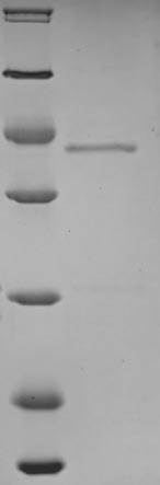 Greater than 90% as determined by SDS-PAGE.Recombinant Human Sodium/Calcium Exchanger 1 (SLC8A1) Protein (His)