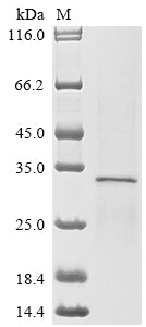 Greater than 85% as determined by SDS-PAGE.Recombinant Human Solute Carrier Organic Anion Transporter Family Member 2B1 (SLCO2B1) Protein (His-Myc)
