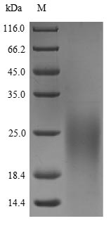 Greater than 90% as determined by SDS-PAGE.Recombinant Human Secreted Ly-6/Upar-Related Protein 1 (SLURP1) Protein (His)