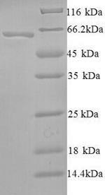 Greater than 90% as determined by SDS-PAGE.Recombinant Human Probable Global Transcription Activator Snf2L2 (SMARCA2) Protein (His)