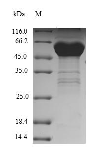 Greater than 90% as determined by SDS-PAGE.Recombinant Human Transcription Activator Brg1 (SMARCA4) Protein (His)