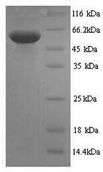 Greater than 90% as determined by SDS-PAGE.Recombinant Mouse Spermine Oxidase (SMOX) Protein (His)