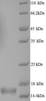 Greater than 90% as determined by SDS-PAGE.Recombinant Human Alpha-Synuclein (SNCA) Protein (His)