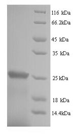 Greater than 90% as determined by SDS-PAGE.Recombinant Human Suppressor Of Cytokine Signaling 1 (SOCS1) Protein (His)