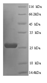 Greater than 90% as determined by SDS-PAGE.Recombinant Rat Suppressor Of Cytokine Signaling 3 (SOCS3) Protein (His)