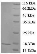 Greater than 90% as determined by SDS-PAGE.Recombinant Rat Sortilin (SORT1) Protein (His)