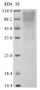 Greater than 90% as determined by SDS-PAGE.Recombinant Human Transcription Factor Sox-9 (SOX9) Protein (His)