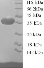 Greater than 90% as determined by SDS-PAGE.Recombinant Mouse Osteopontin (SPP1) Protein (His)