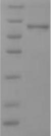 Greater than 90% as determined by SDS-PAGE.Recombinant Human Small Proline-Rich Protein 2B (SPRR2B) Protein (His&Myc)