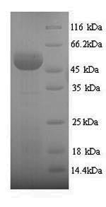 Greater than 90% as determined by SDS-PAGE.Recombinant Human Sulfite Oxidase, Mitochondrial (SUOX) Protein (His)