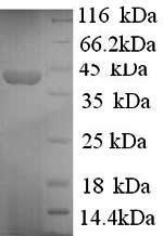 Greater than 90% as determined by SDS-PAGE.Recombinant Human Synapsin-1 (SYN1) Protein (His)