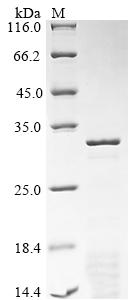 Greater than 85% as determined by SDS-PAGE.Recombinant Rat Synapsin-1 (SYN1) Protein (His)