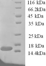 Greater than 90% as determined by SDS-PAGE.Recombinant Human Traf Family Member-Associated Nf-Kappa-B Activator (TANK) Protein (His)