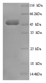 Greater than 90% as determined by SDS-PAGE.Recombinant Human Transcobalamin-1 (TCN1) Protein (His)