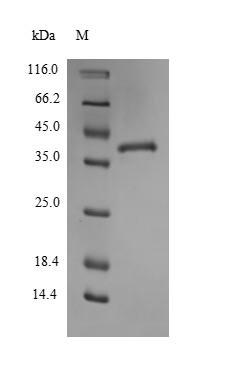 Greater than 90% as determined by SDS-PAGE.Recombinant Mouse Thrombospondin-1 (THBS1) Protein (His)