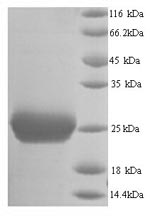 Greater than 90% as determined by SDS-PAGE.Recombinant Mouse Thrombospondin-2 (THBS2) Protein (His)