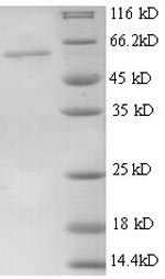 Greater than 90% as determined by SDS-PAGE.Recombinant Mouse Thrombospondin-3 (THBS3) Protein (His)