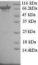 Greater than 90% as determined by SDS-PAGE.Recombinant Human Toll-Like Receptor 8 (TLR8) Protein (His)