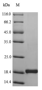 Greater than 90% as determined by SDS-PAGE.Recombinant Human Tumor Necrosis Factor (TNF) Protein (His), Active