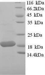 Greater than 90% as determined by SDS-PAGE.Recombinant Sheep Tumor Necrosis Factor (TNF) Protein (His)