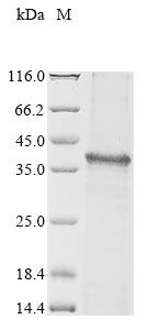 Greater than 85% as determined by SDS-PAGE.Recombinant Mouse Tenomodulin (TNMD) Protein (His)