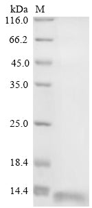 Greater than 85% as determined by SDS-PAGE.Recombinant Human Cellular Tumor Antigen P53 (TP53) Protein (His)