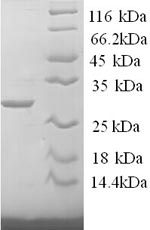 Greater than 90% as determined by SDS-PAGE.Recombinant Mouse Tryptase (TPSAB1) Protein (His)